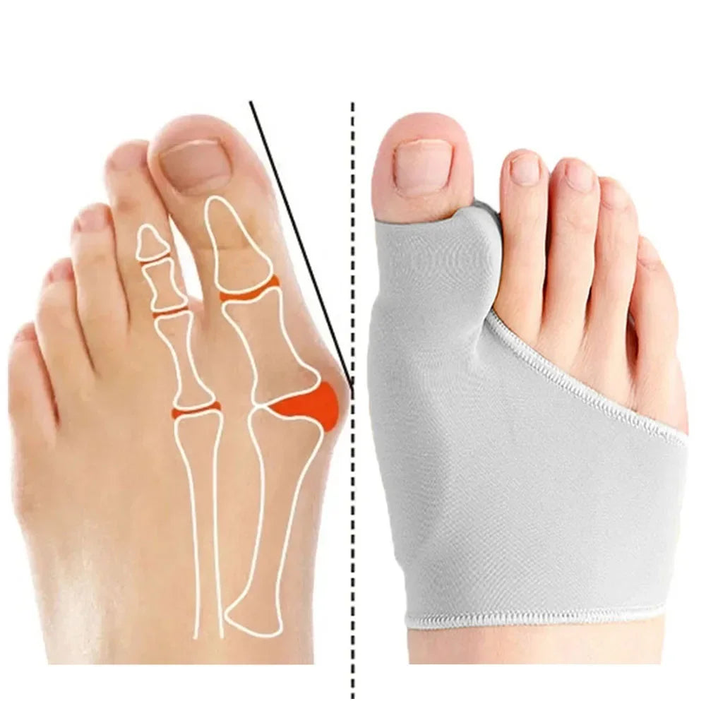 1 pair Toe Separator Hallux Valgus Bunion Corrector/Orthotics