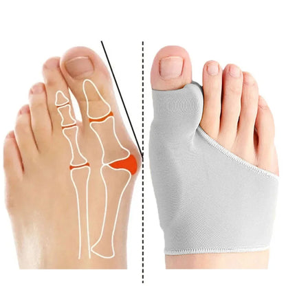 1 pair Toe Separator Hallux Valgus Bunion Corrector/Orthotics